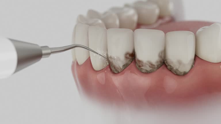 Trusted Tooth Extraction service in Bel Air, MD - Dentist Open Now